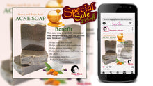 Load image into Gallery viewer, Honey Kojic Acid Acne Soap
